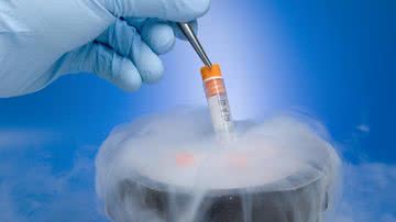 Um dos melhores métodos para mulheres que desejam adiar a gravidez é o congelamento de óvulos