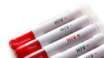 Tubos de ensaio com etiquetas HIV- e HIV+