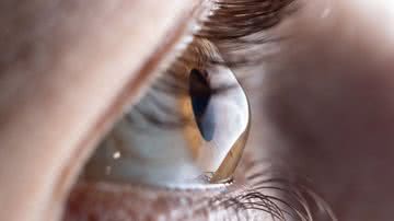 Entenda o ceracotone, que exige atenção desde os primeiros sinais - Foto: Canva Pro