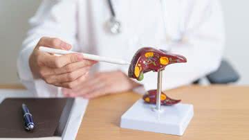 Médico demonstra maquete de fígado, órgão atingido por hepatite