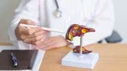 A hepatite A é uma doença causada por um vírus que atinge o fígado - Foto: Canva Pro