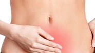 Os miomas submucosos podem ser considerados os grandes vilões