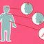 Prevenção é importante - pexels