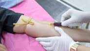 Exames de sangue são importantes - pexels