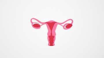 A endometriose pode aparecer em qualquer fase da idade reprodutiva e tem tratamento