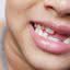 Dentes de leite precisam de cuidados