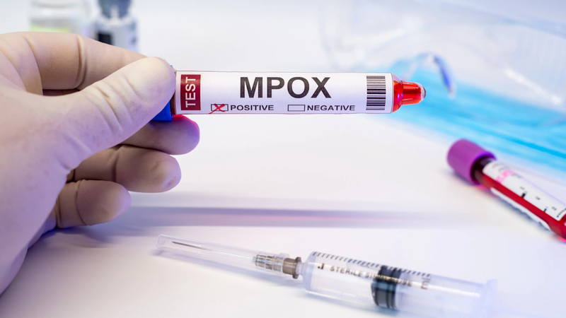 Entre 2022 e 2024, o Brasil registrou 12 mil casos confirmados de mpox - Canva